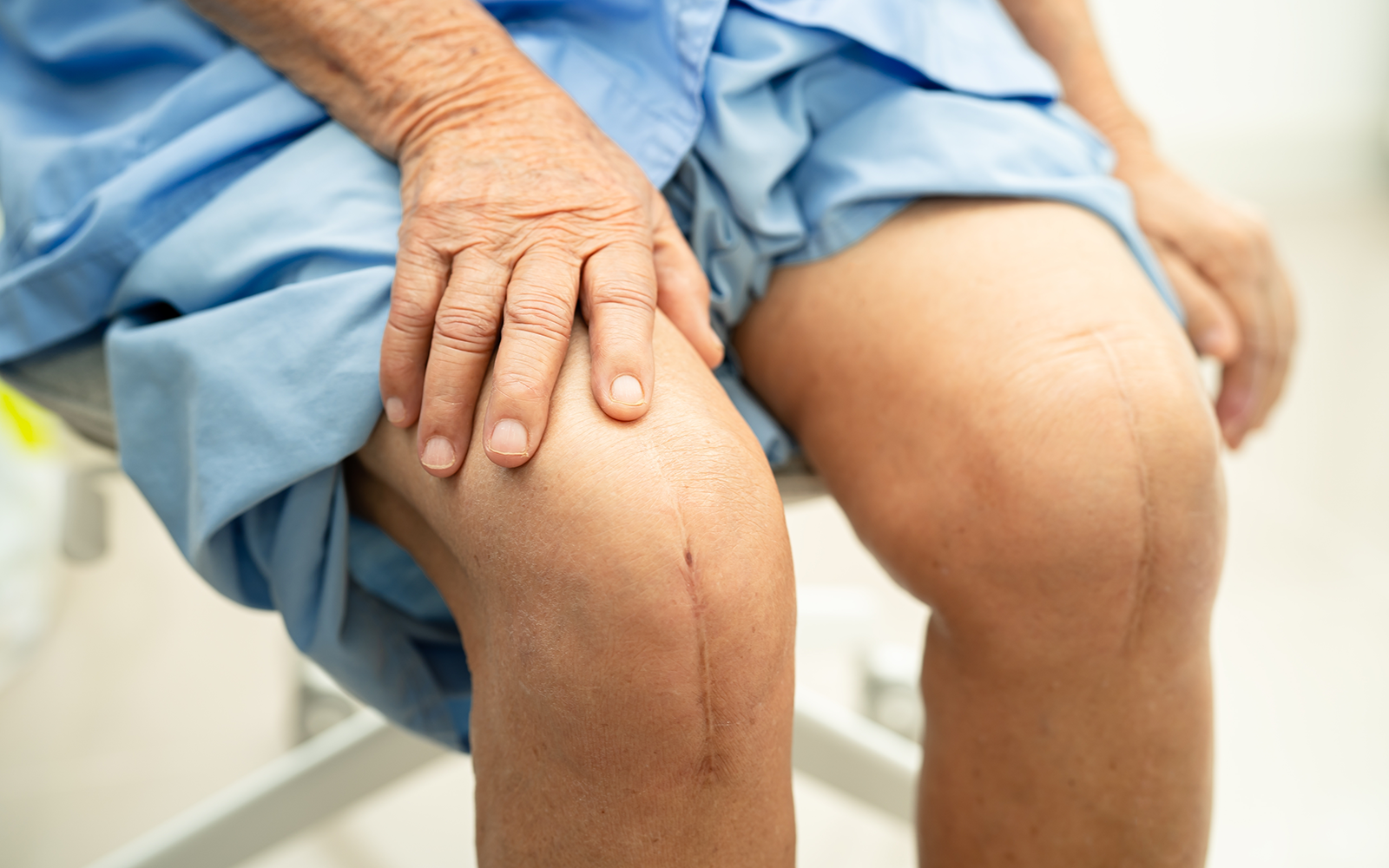 Joint Replacement Surgery for Ankle & Foot in Ahmedabad