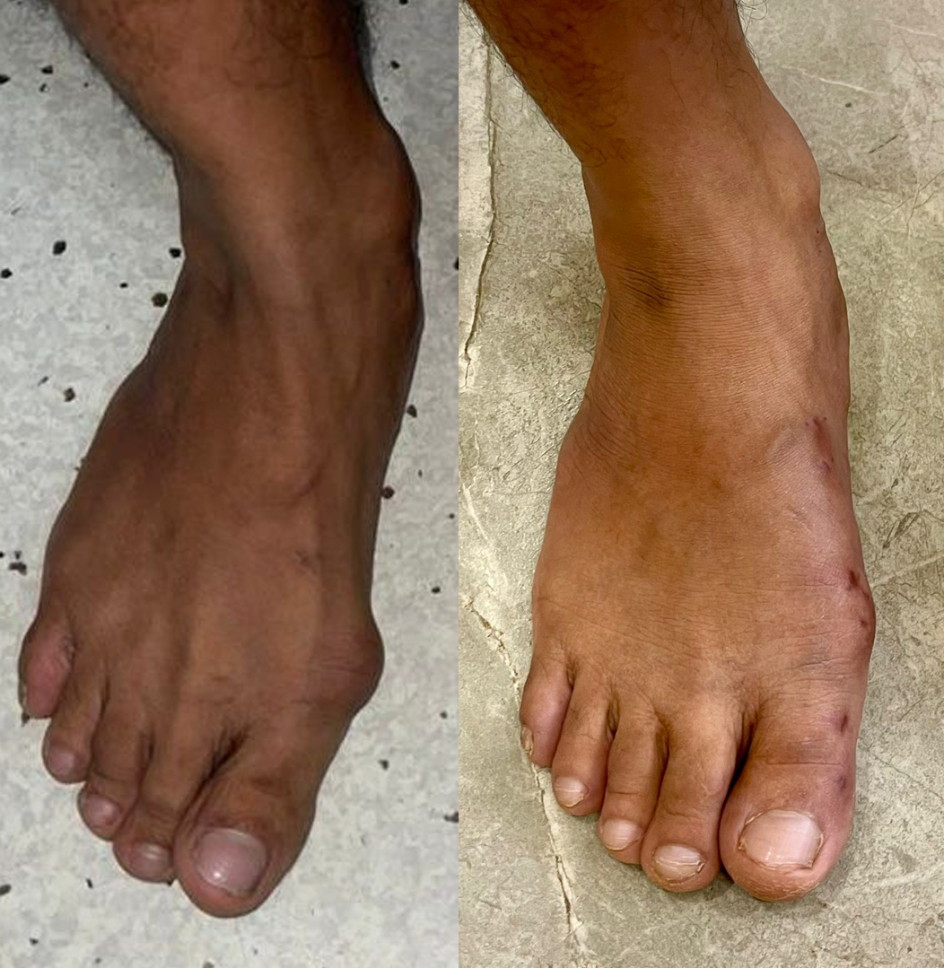 Apex Foot And Ankle Center
