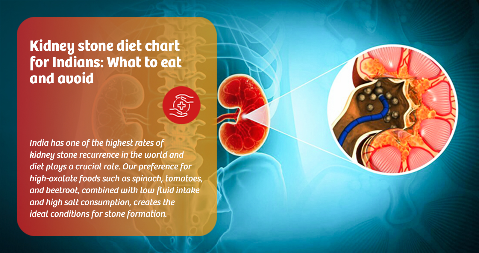 Kidney stone diet chart for Indians: What to eat and avoid