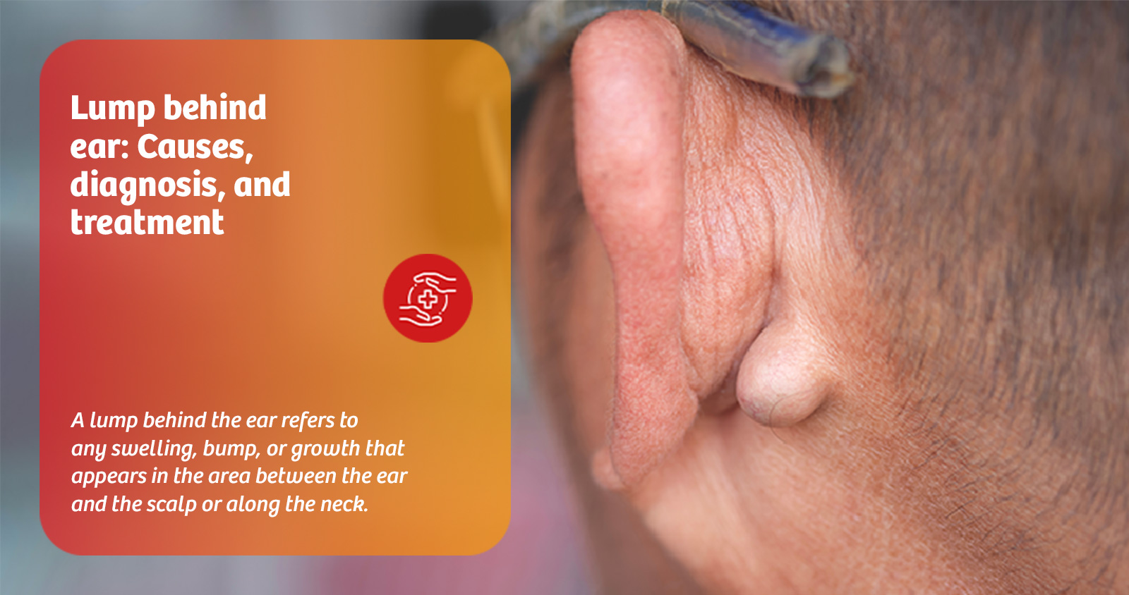 lump-behind-ear-causes-diagnosis-and-treatment